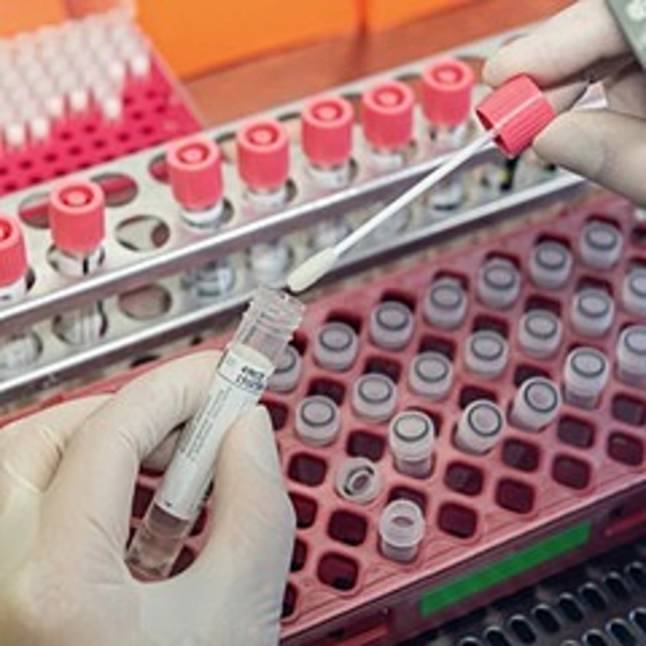 La stratégie tester-tracer-isoler de sortie du confinement peine à prendre sa pleine mesure.