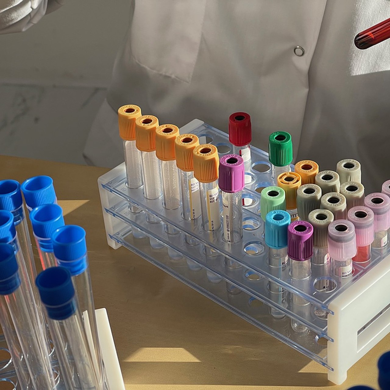 Le périmètre de compétences, les moyens et le rôle de la nouvelle ANRS-MIE doivent être clarifiés, selon la Cour des comptes, car la pérennité des crédits à sa disposition n'est pas garantie à ce jour.