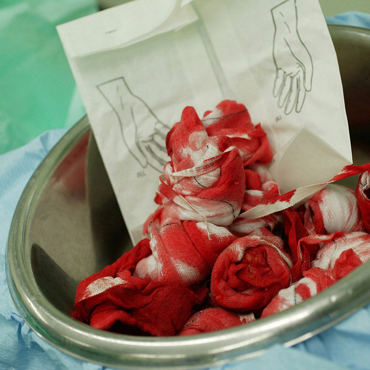 L'intégration des déchets d'activité de soins non dangereux dans la filière des déchets assimilés aux ordures ménagères pourrait compliquer le tri en flux à partir du 1er janvier 2025 : papier, plastique, métal, bois, plâtre, fraction minérale, biodéchets et textile. (Medicimage/BSIP)