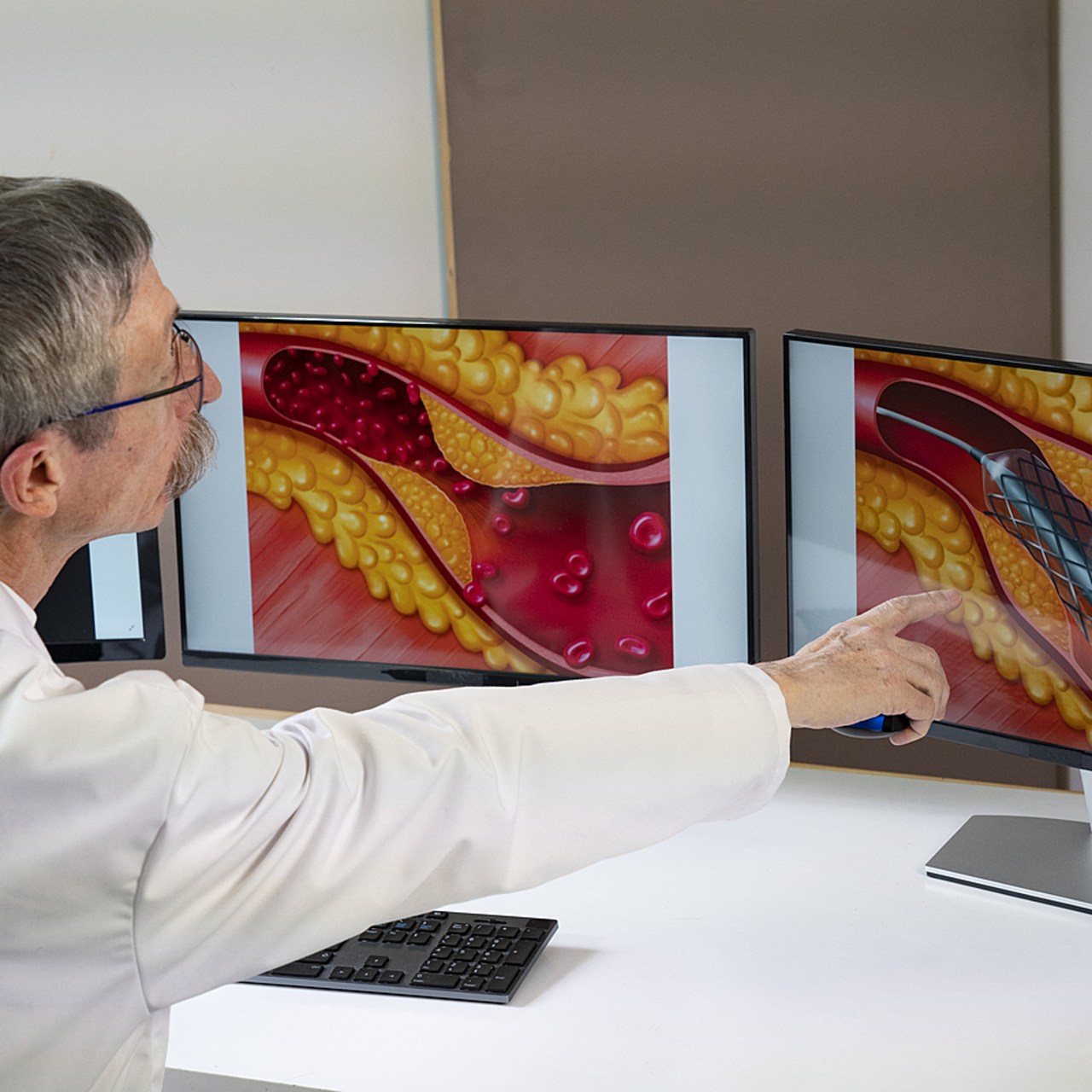 Au CHU de Rennes, des modèles numériques ont été créés afin de placer des stents. (Collanges/Image Point FR/BSIP)