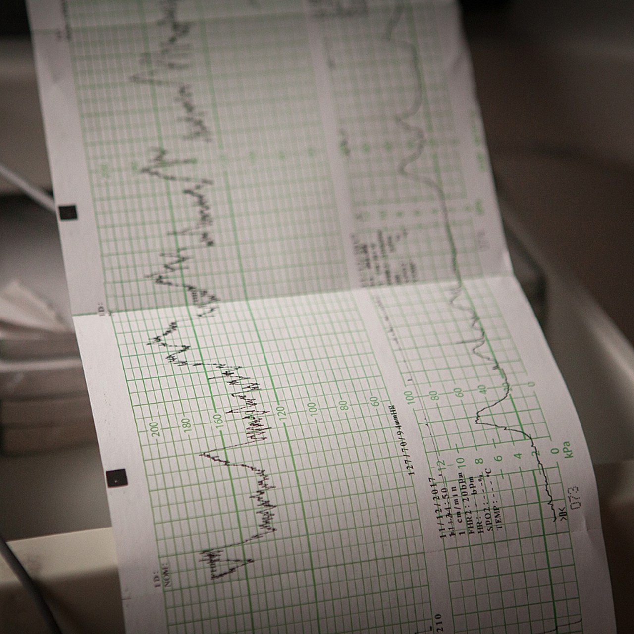 L'accord encadre la fixation des prix d'une grande variété de produits et prestations, allant du pansement au moniteur en passant par les fauteuils roulants. (Jessica Bordeau/Image Point FR/BSIP)