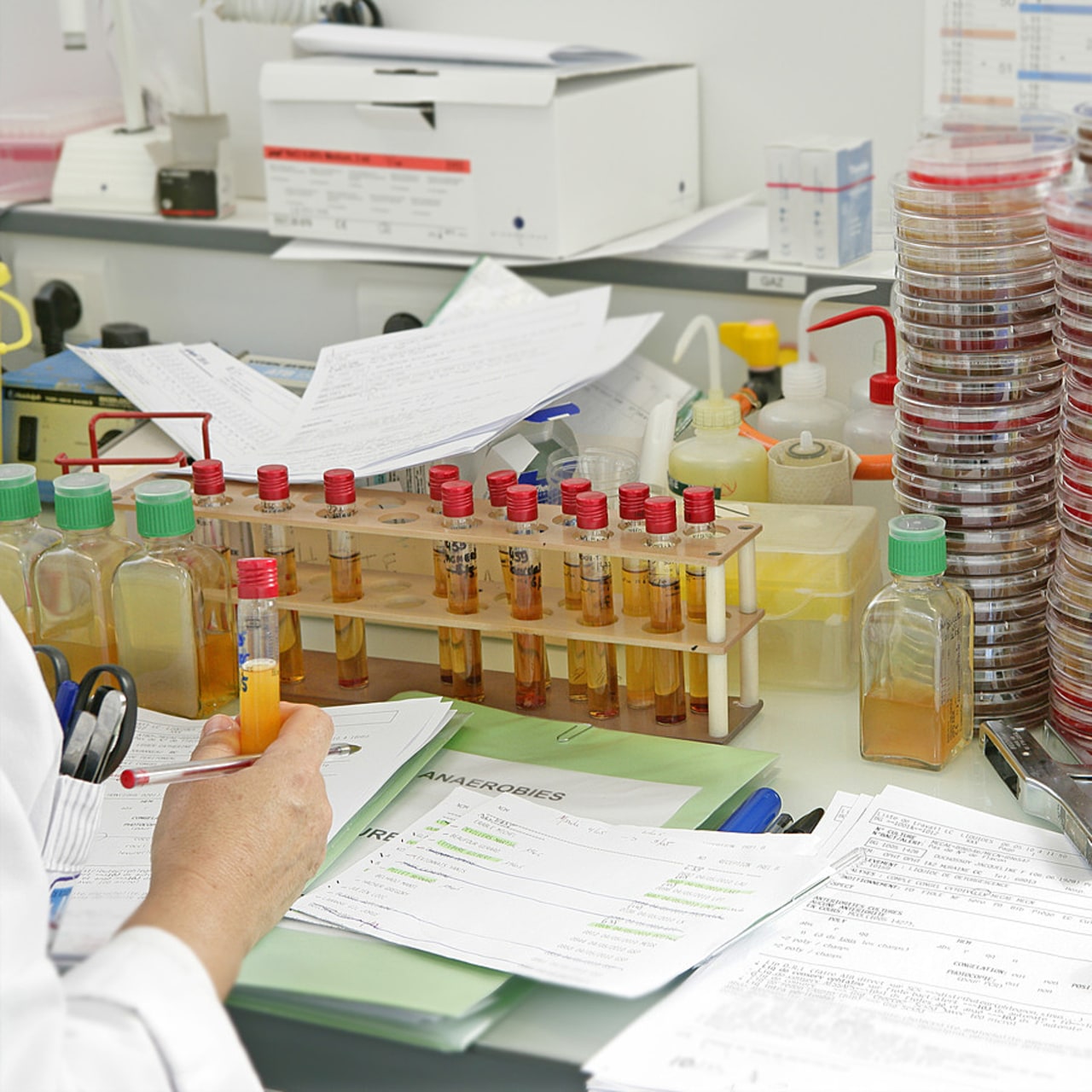 Le CHU de Nancy a déployé depuis 2022 une solution logicielle de surveillance du risque infectieux. (Chassenet/BSIP)