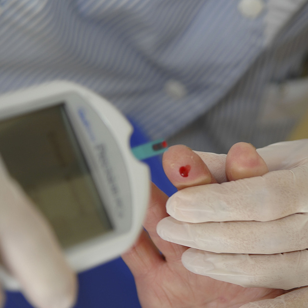 Les usagers pourront répondre à un questionnaire et se faire dépister par un simple dosage biologique NTproBNP au doigt, à l'instar de la glycémie capillaire. (Jose Oto/BSIP)