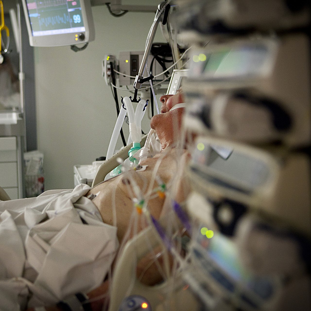 La prise en charge en réanimation étant lourde et invasive, il est particulièrement important pour les médecins réanimateurs d'évaluer de manière fine le pronostic des patients âgés afin de prendre la bonne décision. (Amélie Benoist/Image point FR/BSIP)