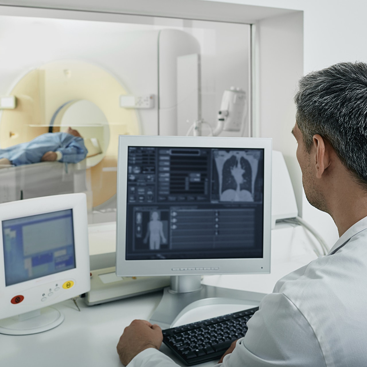 La finalisation de l'étude Cascade permettra d'apporter à l'Institut national du cancer des informations essentielles sur les modalités de lecture des scanners avant le lancement d'une large étude. (SPL/BSIP)