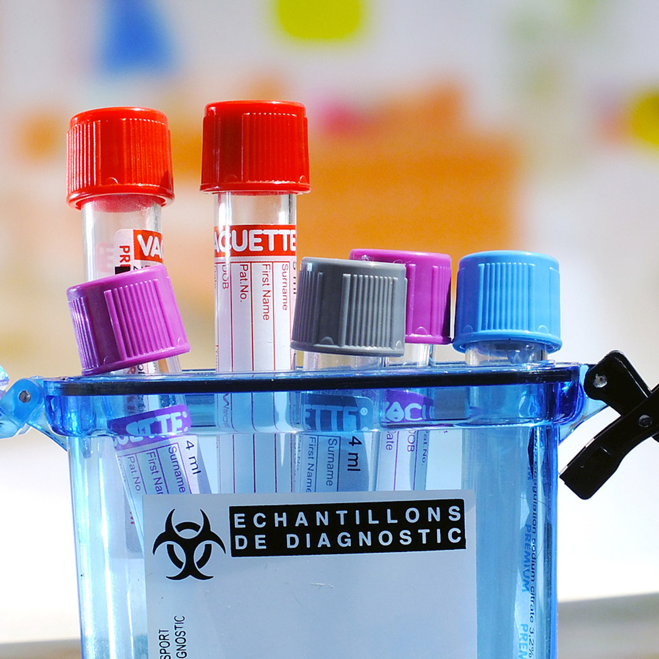 La journée mondiale de la sécurité des patients le 17 septembre porte sur la sécurité diagnostique. Les erreurs diagnostiques sont très souvent multifactorielles, combinant causes systémiques (procédures, travail en équipe, communication...) et cognitives (connaissances et compétences). (Houin/BSIP)