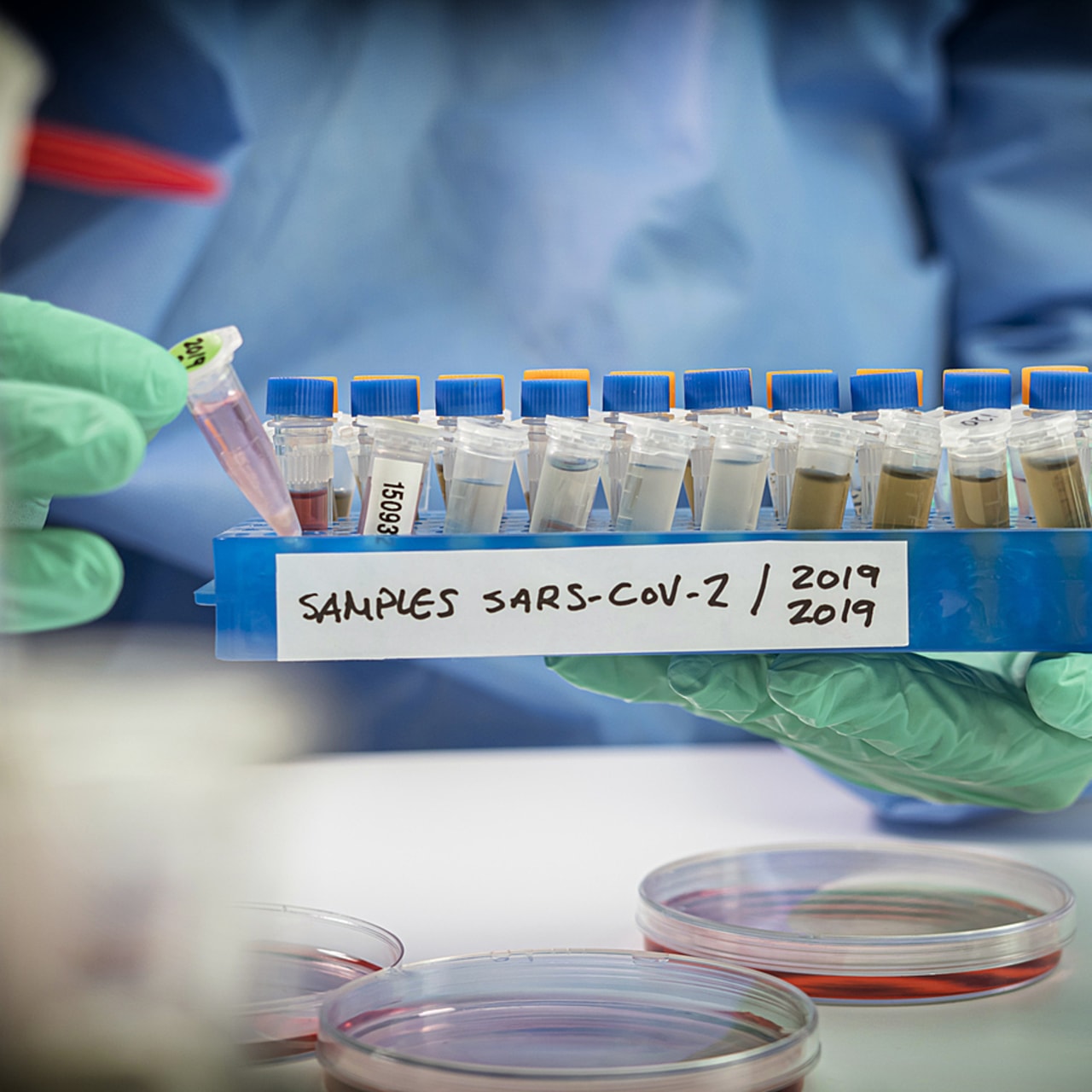 Se préparer à la crise suivante et réagir rapidement en apprenant de la crise Covid-19 est l'objectif premier de la stratégie d'accélération des maladies infectieuses émergentes. (SPL/BSIP)