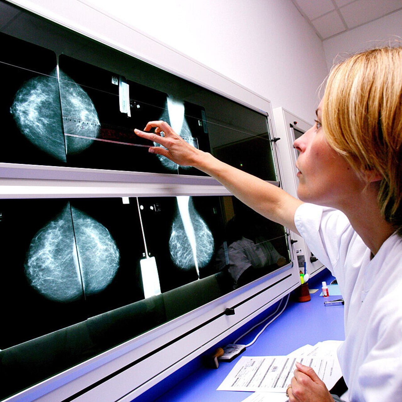 Pour la plupart des CRCDC, les secondes relectures ne sont pas financées pour l'année 2024 car elles sont désormais intégrées dans l'enveloppe globale du budget de fonctionnement, elle-même réduite par rapport à 2023. (Burger/Phanie)