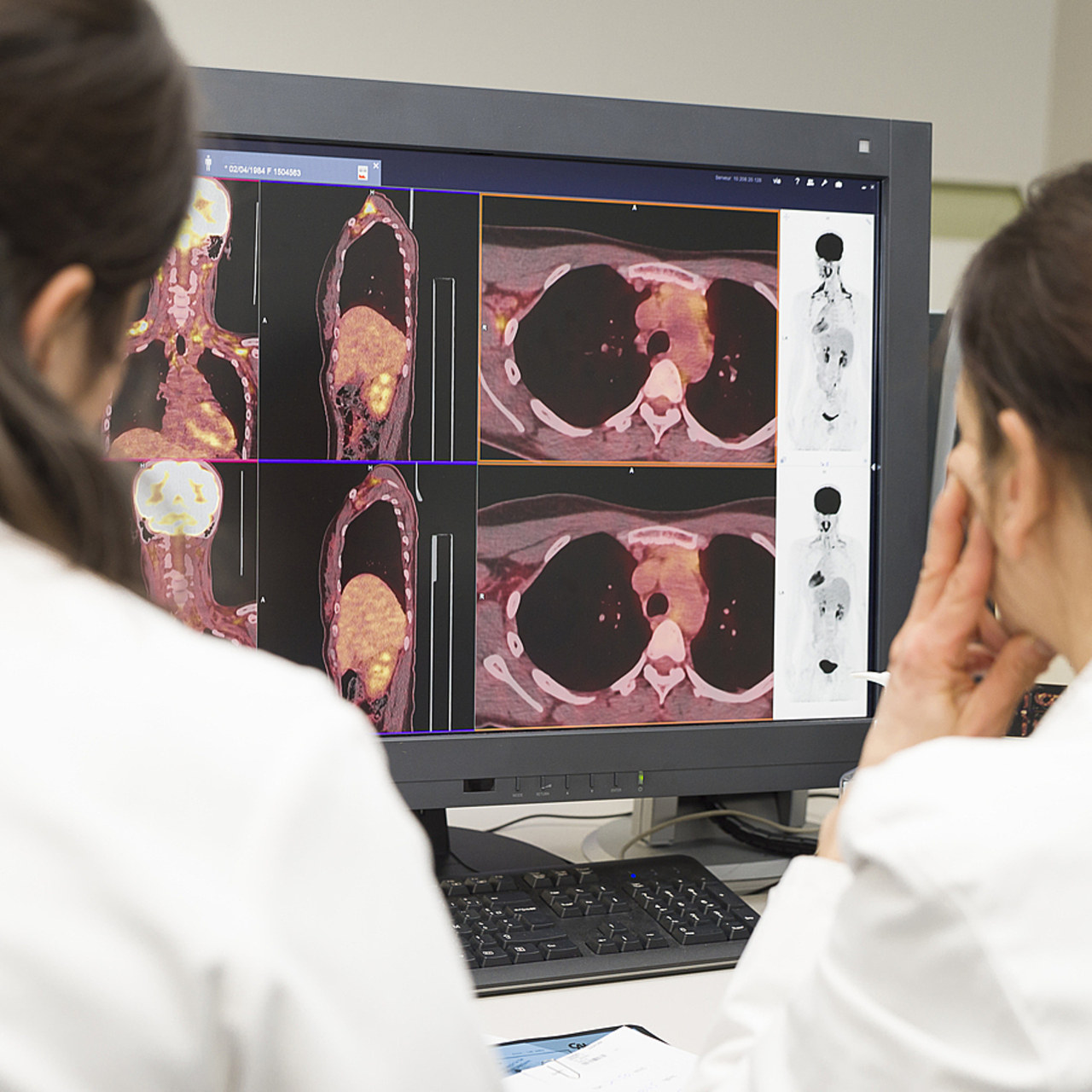 La lutte contre le cancer nécessite de nombreux investissements. Ceux-ci pourraient être mis à mal par le manque de financement du secteur privé à but non lucratif. (A. Noor/Image Point FR/BSIP)