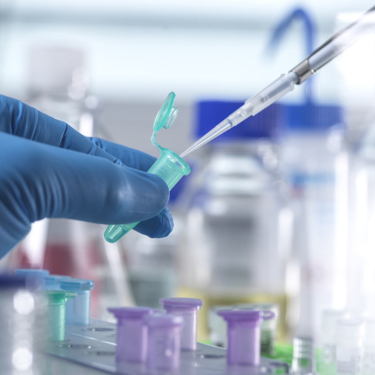 En Europe, moins de 27% des start-up spécialisées dans l'oncologie atteignent un stade de croissance avancé, contre 40% aux États-Unis. (SPL/BSIP)