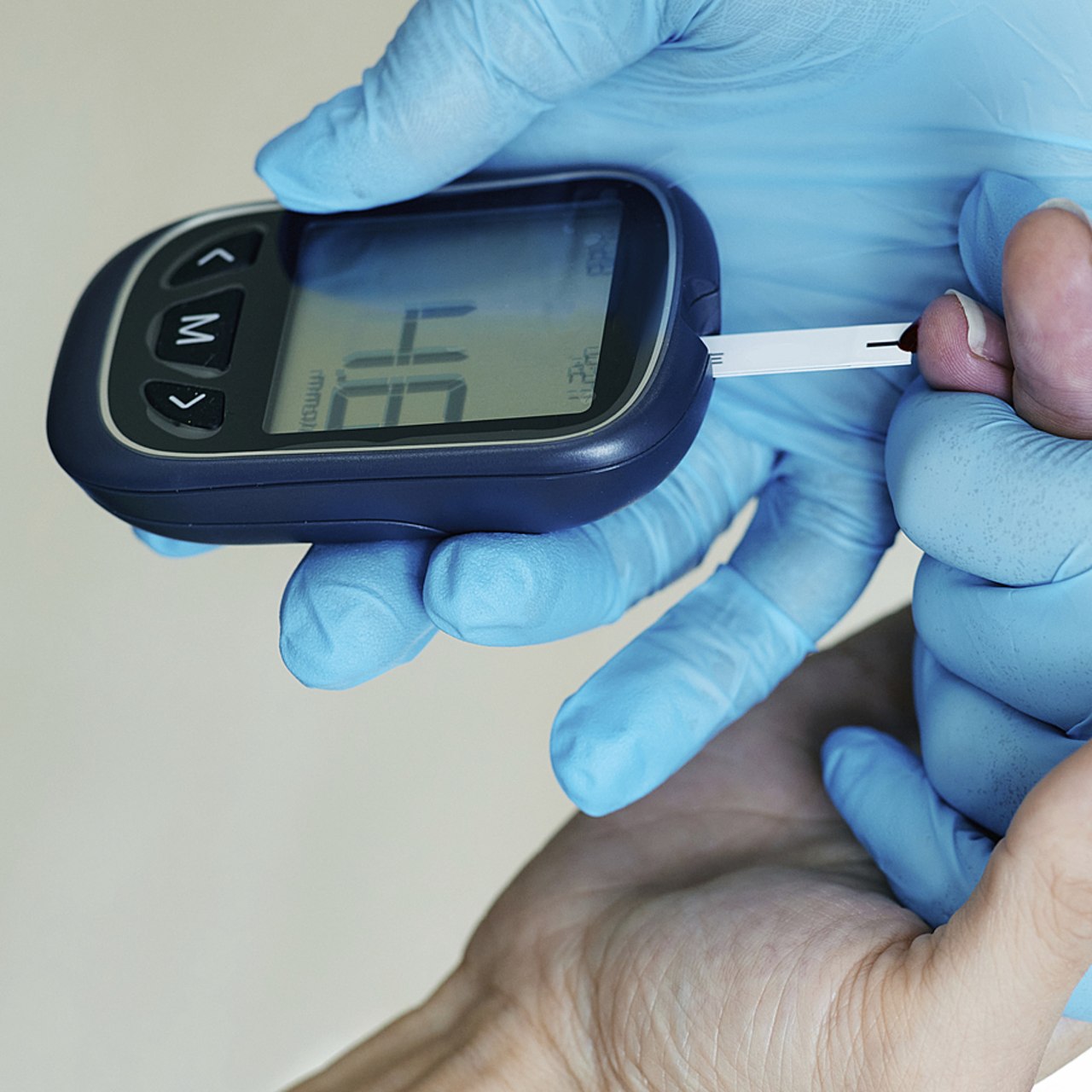 Les indicateurs de qualité de prise en charge du diabète restent "insatisfaisants" alors que le nombre de patients concernés et les dépenses associées à la maladie ne cessent d'augmenter. (SPL/BSIP)