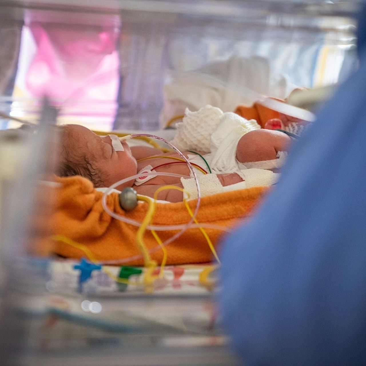 Elle-même facteur de risque de mortalité néonatale, la prématurité des nouveau-nés est associée à plusieurs facteurs de risque socio-économiques. (Jessica Bordeau/Image point FR/BSIP)