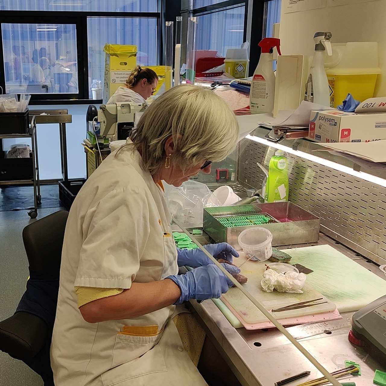 Les médecins pathologistes rejettent le qualificatif de rentiers, en réaction à l'analyse de la Caisse nationale de l'assurance maladie sur les pratiques d'optimisation financière. (Perrine Debacker/Hospimedia)