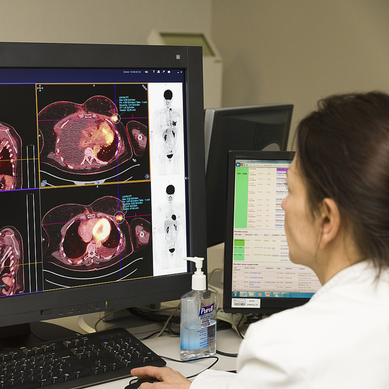 Le déploiement du registre national des cancers reposera sur le pilotage national des registres existants, la consolidation progressive de nouvelles sources de donnée et une gouvernance associant toutes les parties prenantes. (A. Noor/Image Point FR/BSIP)