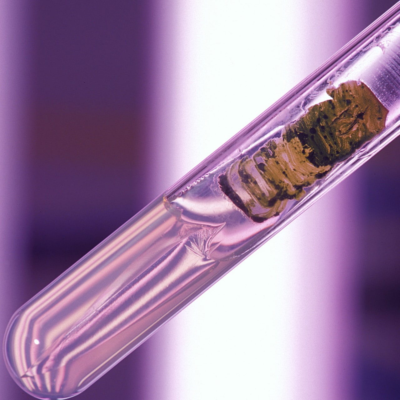 La recherche clinique prend beaucoup de temps et d'argent. Il faut bien évaluer son apport dans un projet. (Raguet H./BSIP)