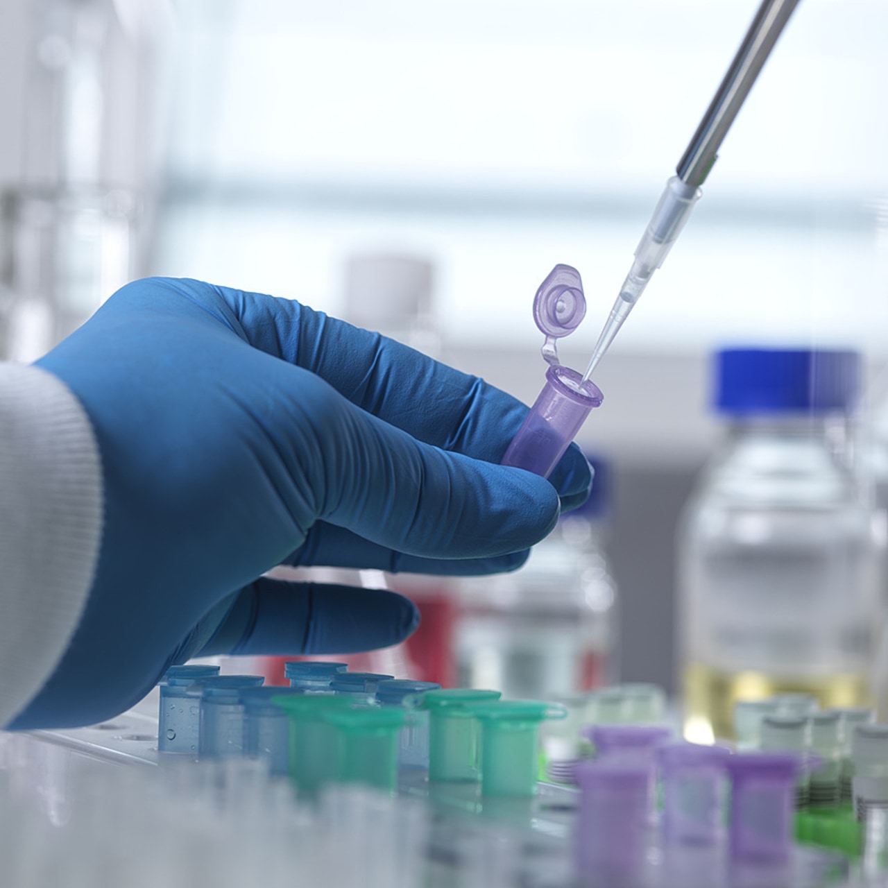 La médecine adaptative vise à proposer à chaque patient la stratégie thérapeutique la plus appropriée dans le temps, en ajustant le suivi et les traitements à la dynamique propre de sa tumeur. (SPL/BSIP)