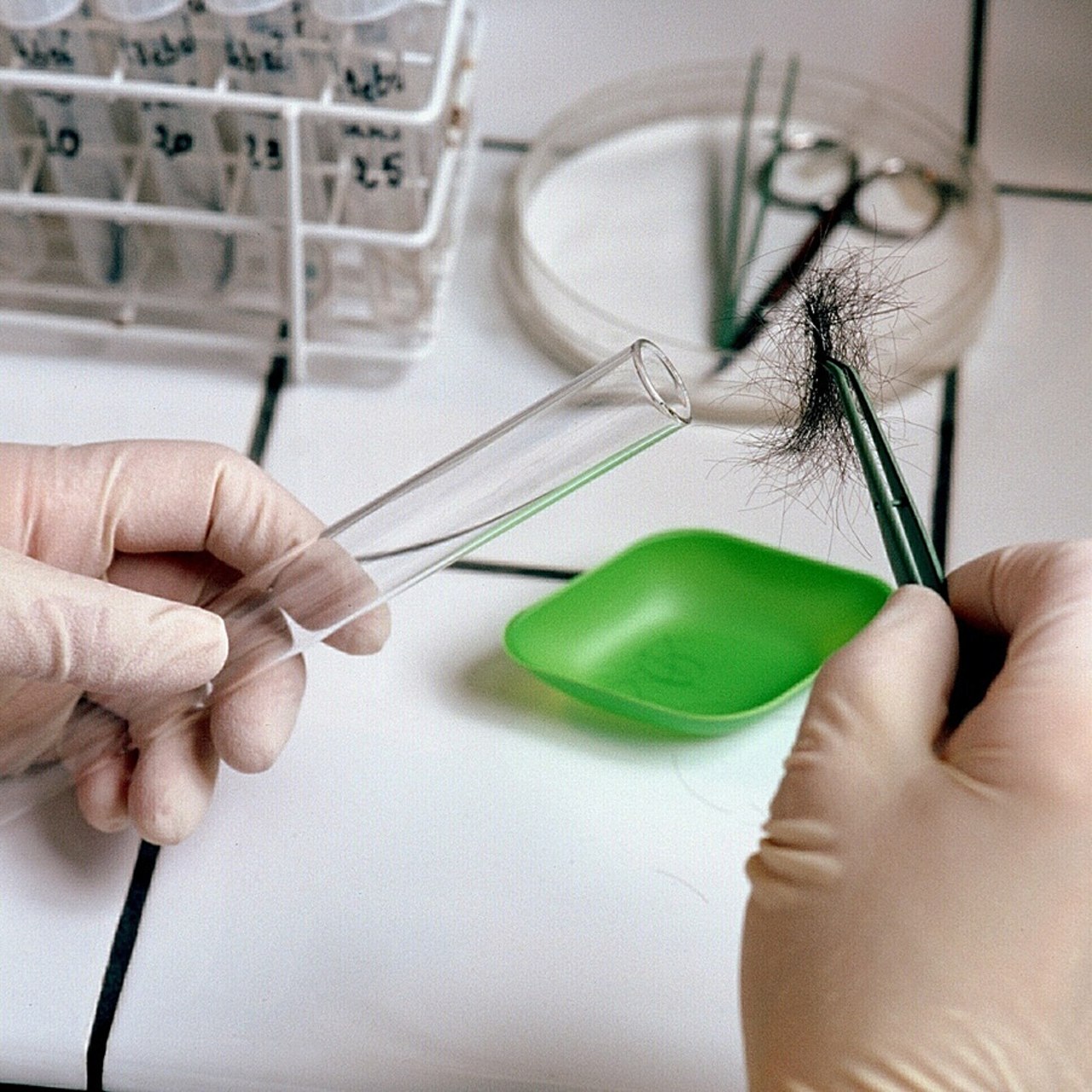 Les nouveaux actes de prélèvement capillaire ne sont pas encore intégrés dans les logiciels métiers, à cause d'ambiguïtés et d'anomalies. (Burger/Phanie)