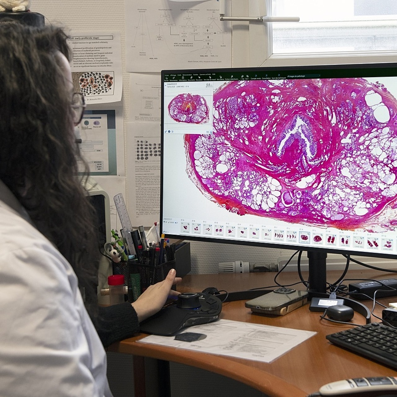 La plateforme numérique partagée permet aux équipes du CHU et du CH du Mans de se relayer plus facilement en cas de tension sur les ressources humaines. (Catherine Jouannet/CHU d'Angers)