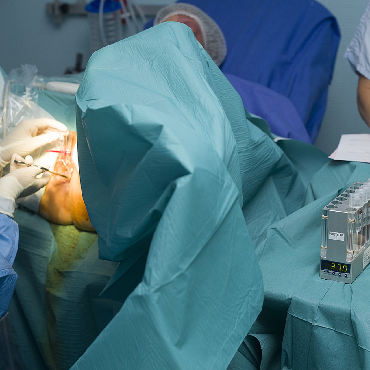 La réponse à la nouvelle demande d'autoconservation des ovocytes est aussi freinée par un accès limité aux blocs opératoires pour réaliser la ponction. (A. Noor/Image Point FR/BSIP)