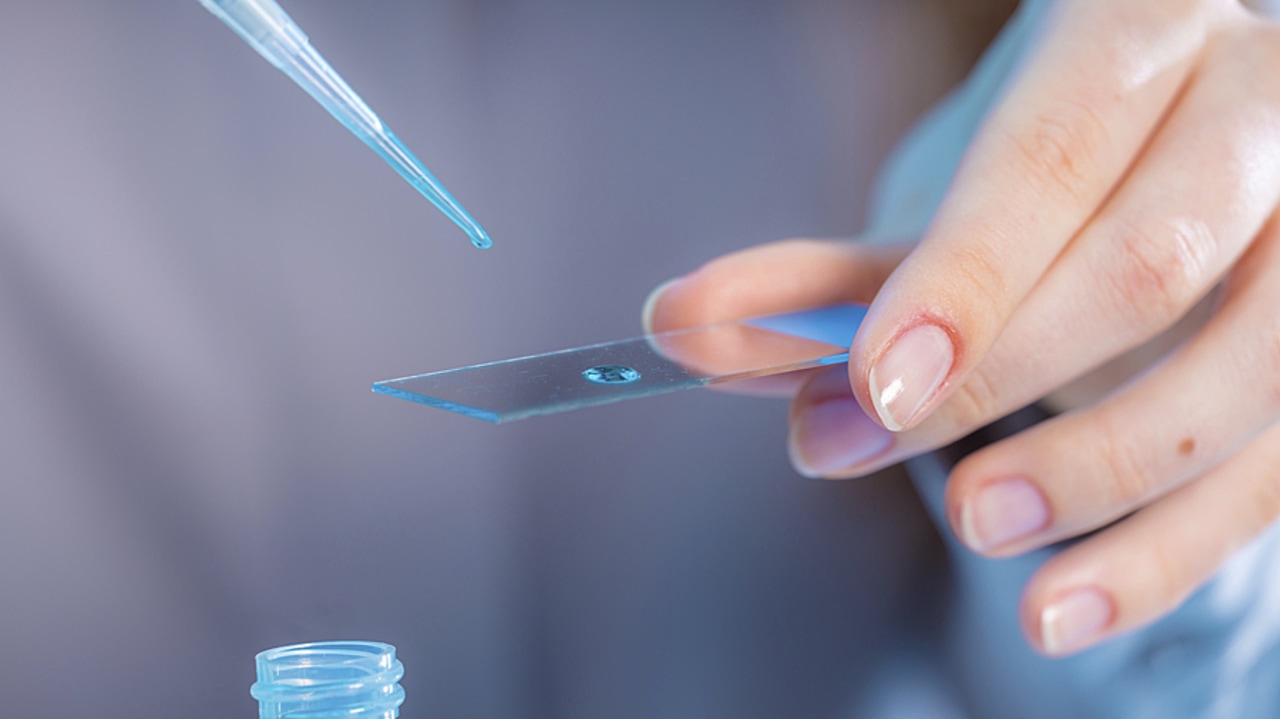 Les moyens des appels à projets de recherche sur les soins et l'offre de soins restent majoritairement alloués aux projets promus par les CHU. (SPL/BSIP)