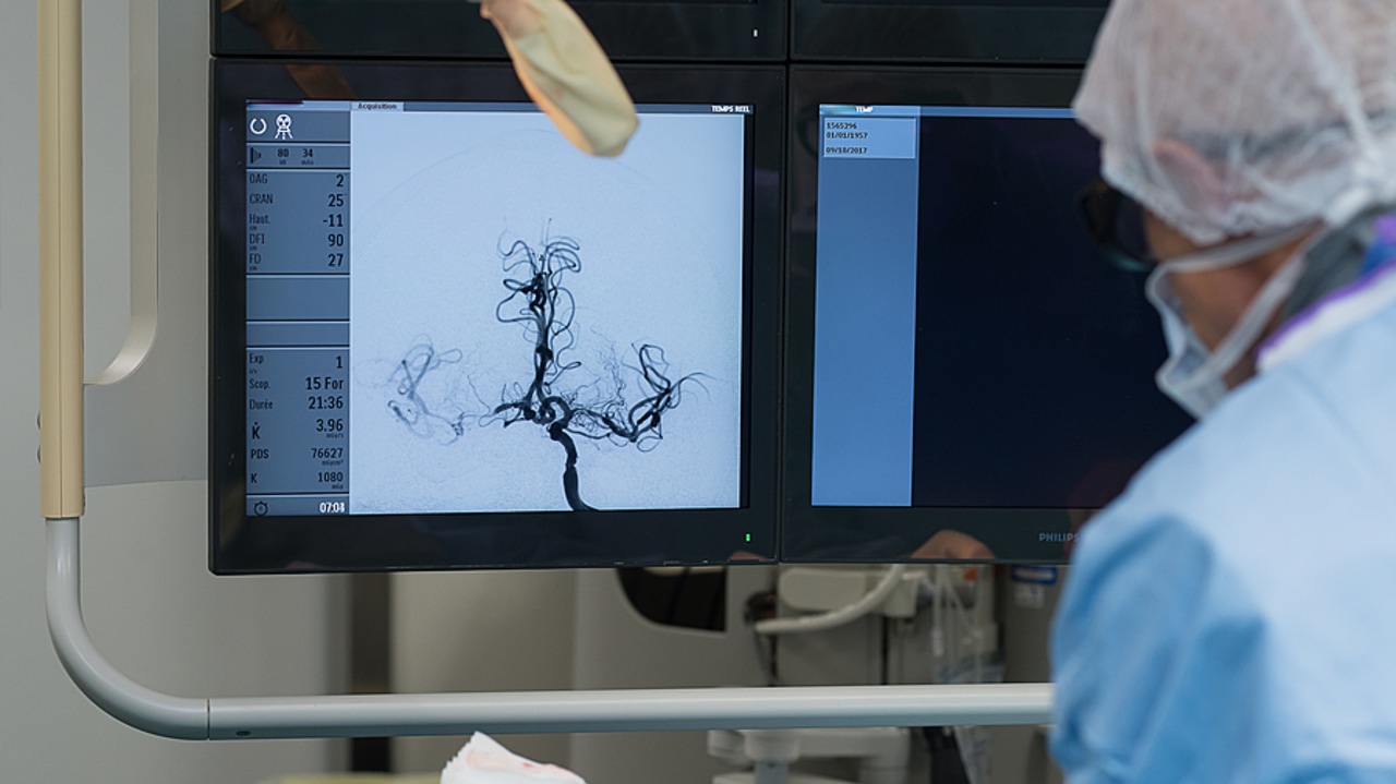 L'Académie nationale de médecine préconise d'organiser la filière par territoires avec environ trois unités neurovasculaires dont une avec thrombectomie pour 1,2 million d'habitants. (A. Noor/Image Point FR/BSIP)