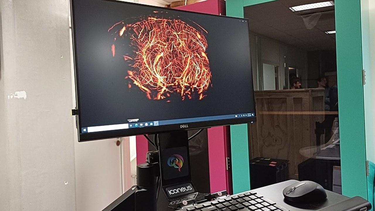 La start-up Iconeus, implantée à Paris biotech santé, développe  une technologie d'imagerie ultrarapide des flux sanguins cérébraux basée sur  des travaux issus d'équipes de recherche françaises. (Pia Hémery/Hospimedia)