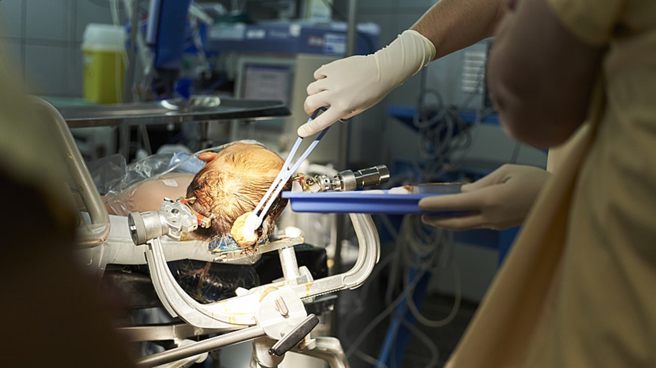 La chirurgie pédiatrique est reconnue comme une modalité dans les autorisations, mais l'absence de spécialité dans l'anesthésie-réanimation complique l'accès effectif des enfants aux blocs opératoires. (Bienaimé/ BSIP)