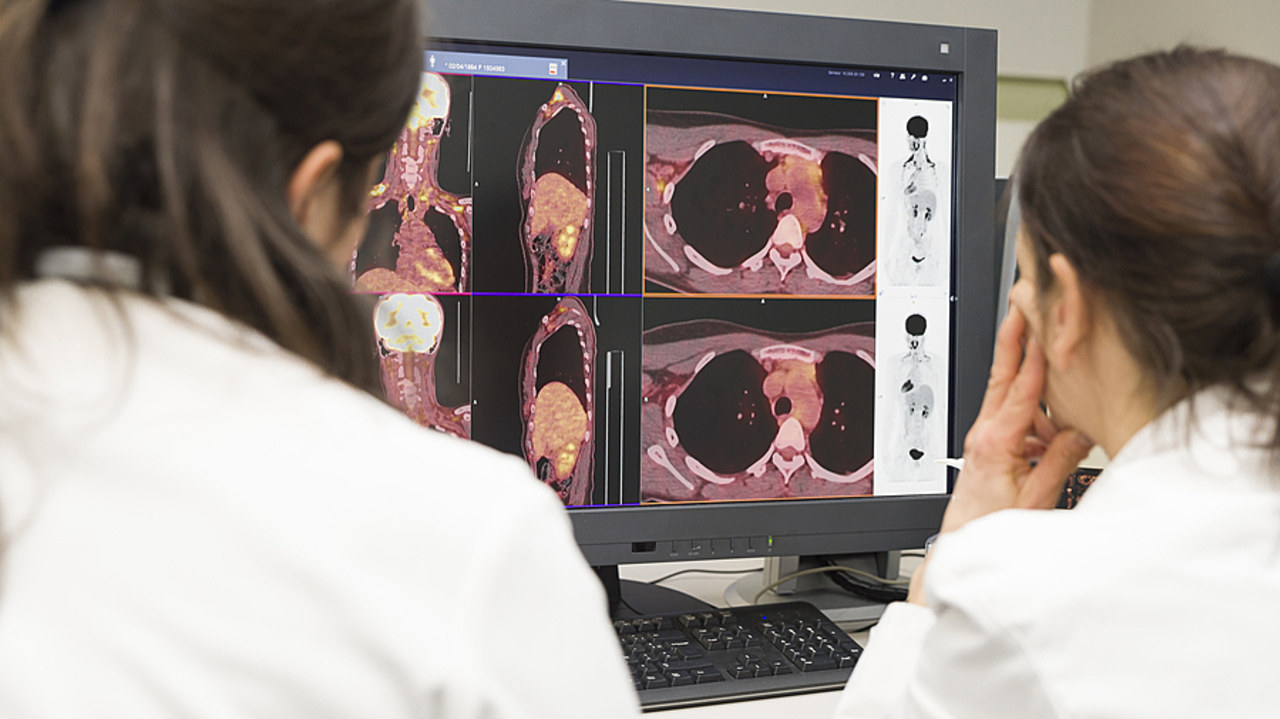 La lutte contre le cancer nécessite de nombreux investissements. Ceux-ci pourraient être mis à mal par le manque de financement du secteur privé à but non lucratif. (A. Noor/Image Point FR/BSIP)