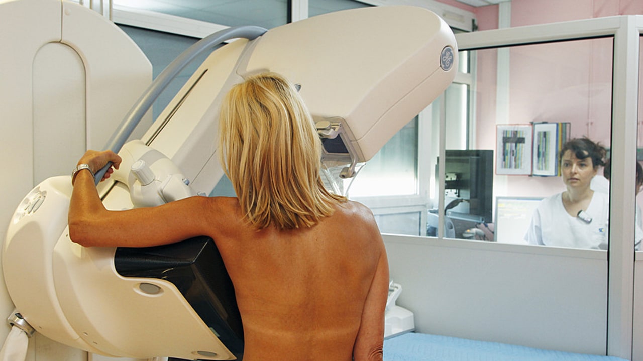 La mission soulève les difficultés de connaître le parc d'équipements et sa répartition, notamment celui des mammographes. Elle préconise de lancer une étude pour mesurer si l'accessibilité de l'offre influe sur le recours au dépistage du cancer du sein. (Astier/CHU de Lille)