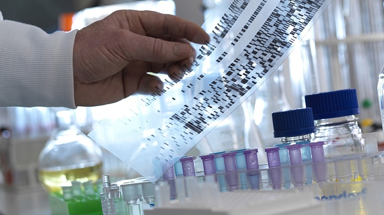 Les négociations sont encore en cours pour la première inscription dans le droit commun d'un acte évalué par la Haute Autorité de santé, afin de le sortir du référentiel des actes innovants hors nomenclature. (SPL/BSIP)