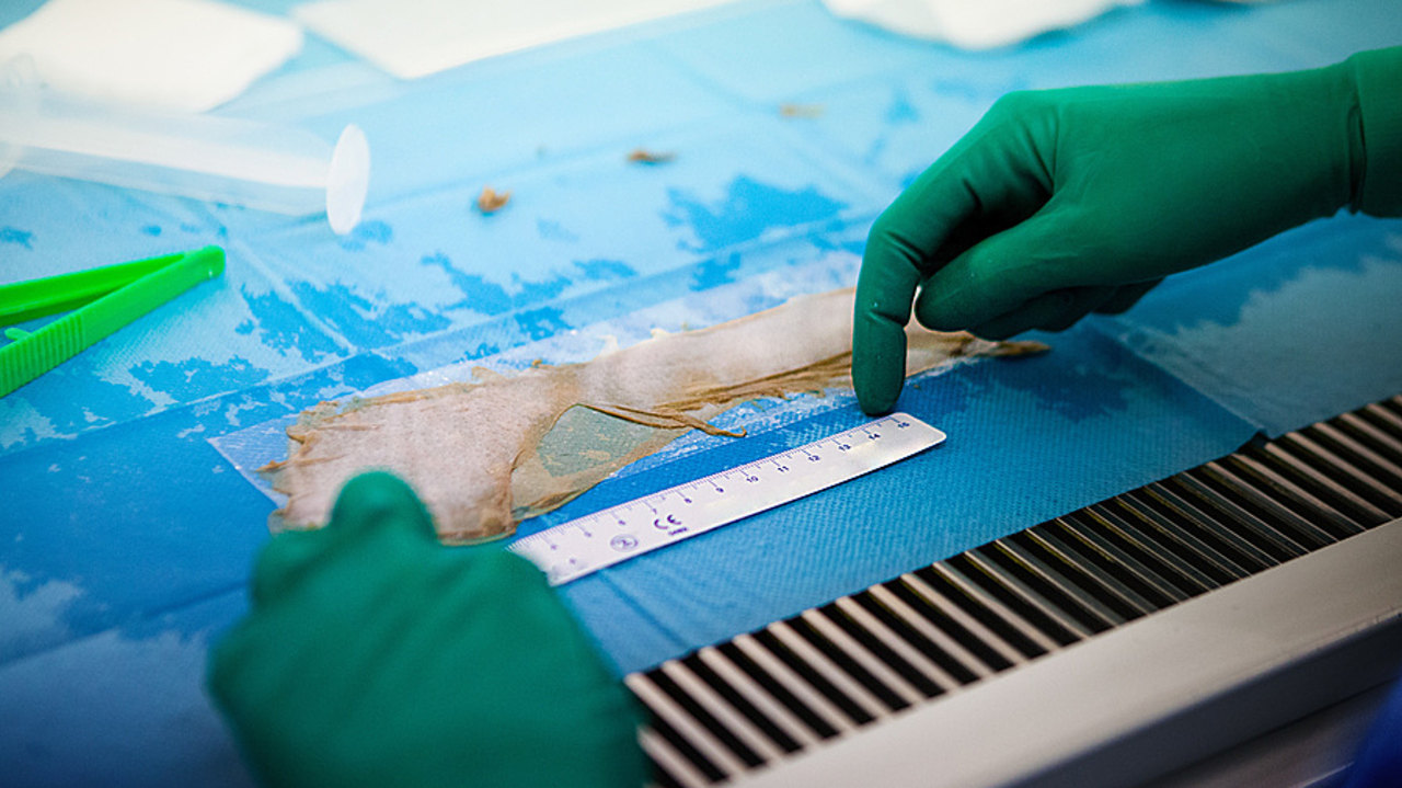 Si la sécurité sanitaire est jugée globalement satisfaisante et le positionnement européen de la France favorable en matière de greffe de tissus, la mission Igas souligne d'importantes faiblesses structurelles. (Amélie Benoist/Image Point FR/BSIP)