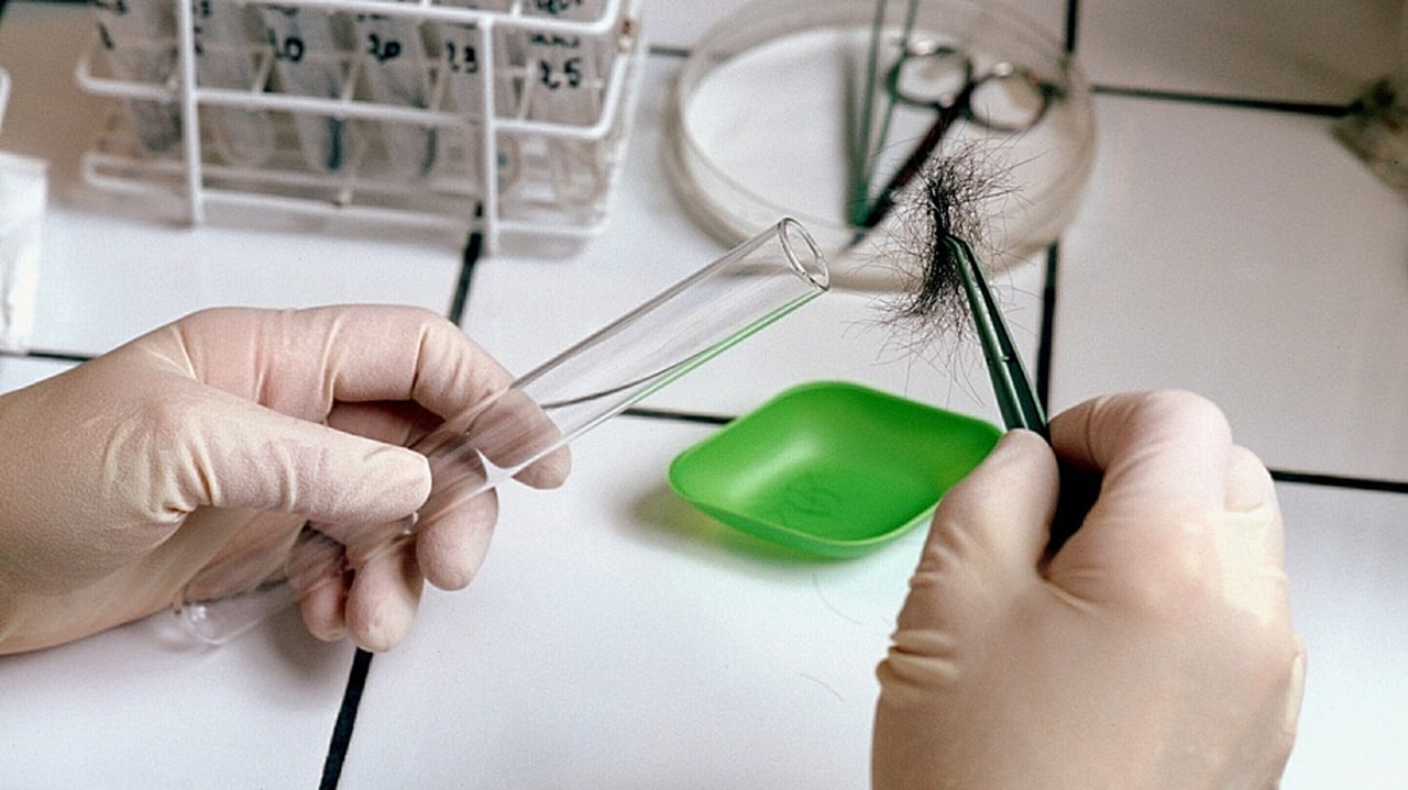 Les nouveaux actes de prélèvement capillaire ne sont pas encore intégrés dans les logiciels métiers, à cause d'ambiguïtés et d'anomalies. (Burger/Phanie)