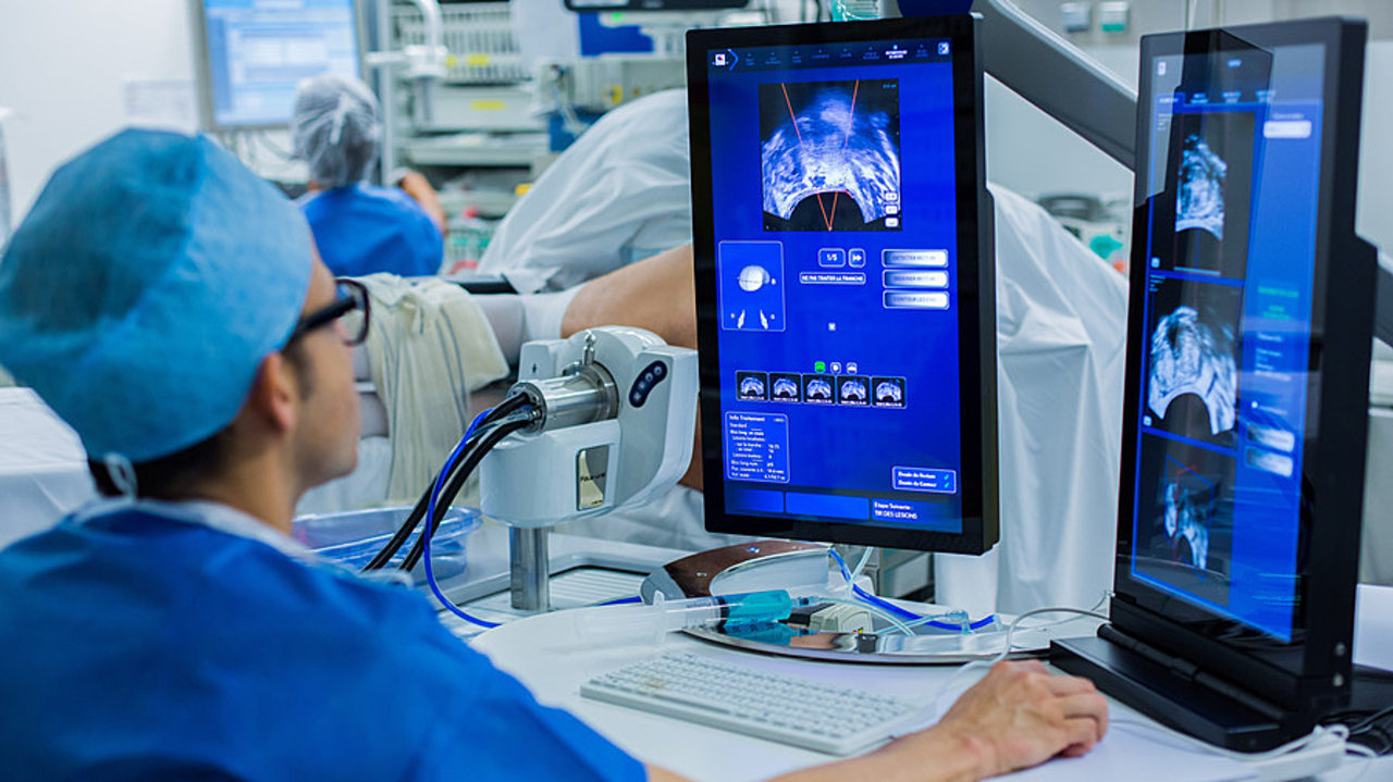 Jusqu'à janvier 2026, l'accès au traitement du cancer localisé de la prostate par ultrasons focalisés de haute intensité était freiné par l'absence de remboursement en dehors de centres experts. (IMM-Garo/Phanie)