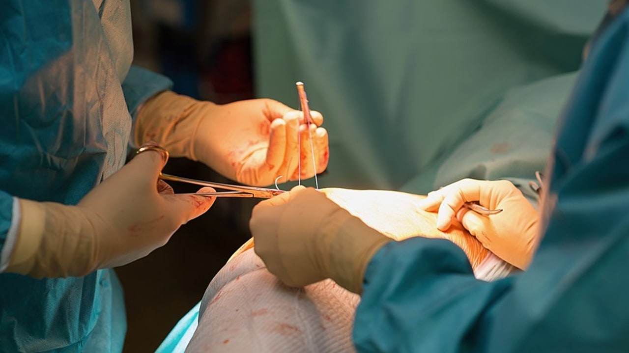 À l'échelon national, les infections du site opératoire sont la troisième cause d'infection nosocomiale, avec un degré d'incidence sur 2 à 3% des interventions chirurgicales. (A. Noor/Image Point FR/BSIP)