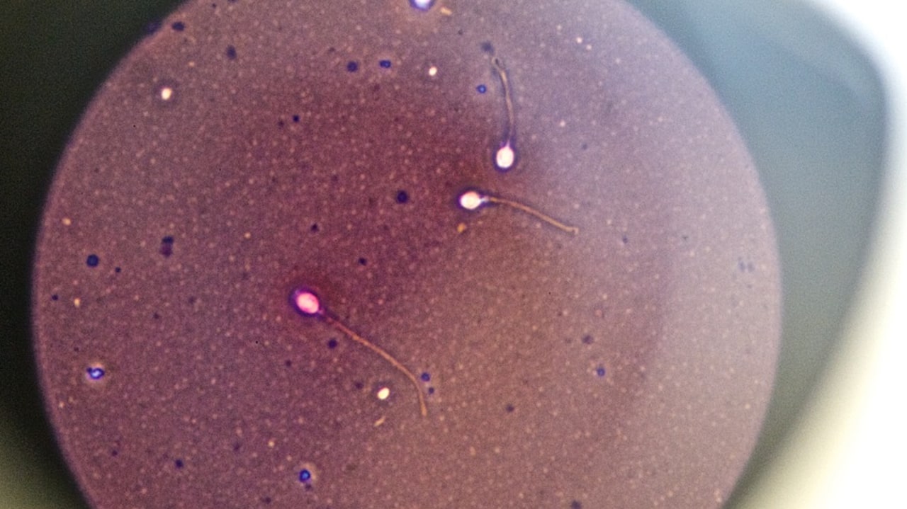 L'augmentation du nombre de donneurs de spermatozoïdes demeure insuffisante pour répondre à l'ensemble des projets parentaux dans des délais suffisants. (L. Souci/BSIP)