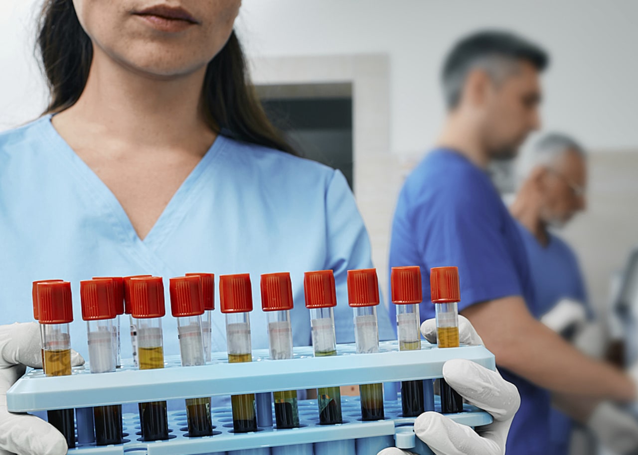 Le rapport du HCERES sur l'Inserm souligne l'importance de donner des vues stratégiques et d'assurer un rôle de pilote de l'agence, un chantier auquel Didier Samuel, son PDG, doit s'atteler. (SPL/BSIP)