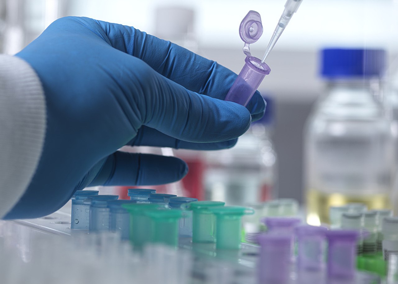 La médecine adaptative vise à proposer à chaque patient la stratégie thérapeutique la plus appropriée dans le temps, en ajustant le suivi et les traitements à la dynamique propre de sa tumeur. (SPL/BSIP)