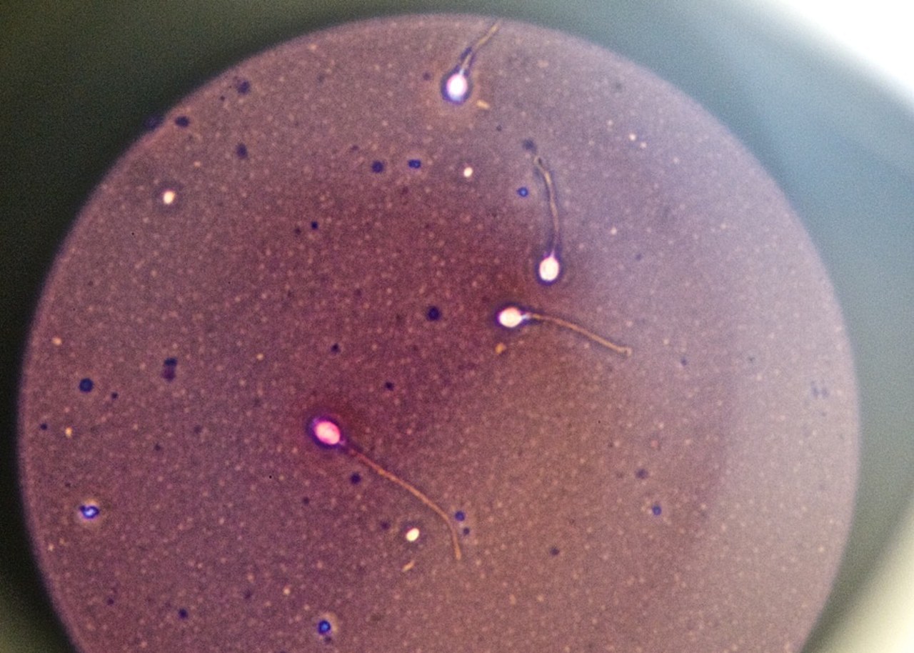 L'augmentation du nombre de donneurs de spermatozoïdes demeure insuffisante pour répondre à l'ensemble des projets parentaux dans des délais suffisants. (L. Souci/BSIP)
