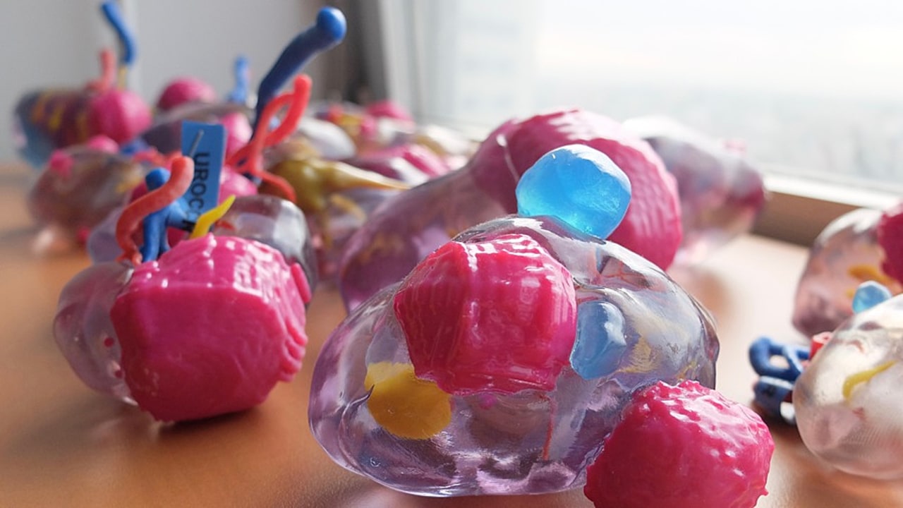 Chaque couleur du rein imprimé a une fonction précise, la tumeur est par exemple en rose.