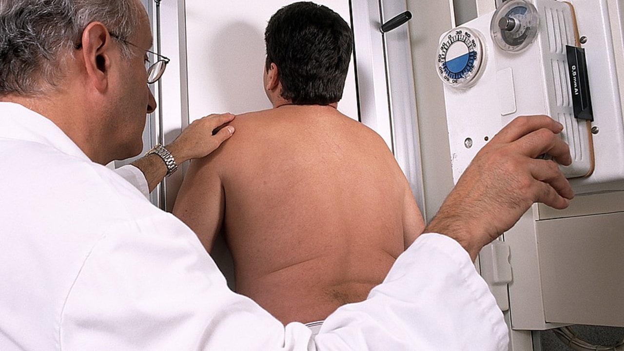 L'obésité touche aujourd'hui un Français sur six.