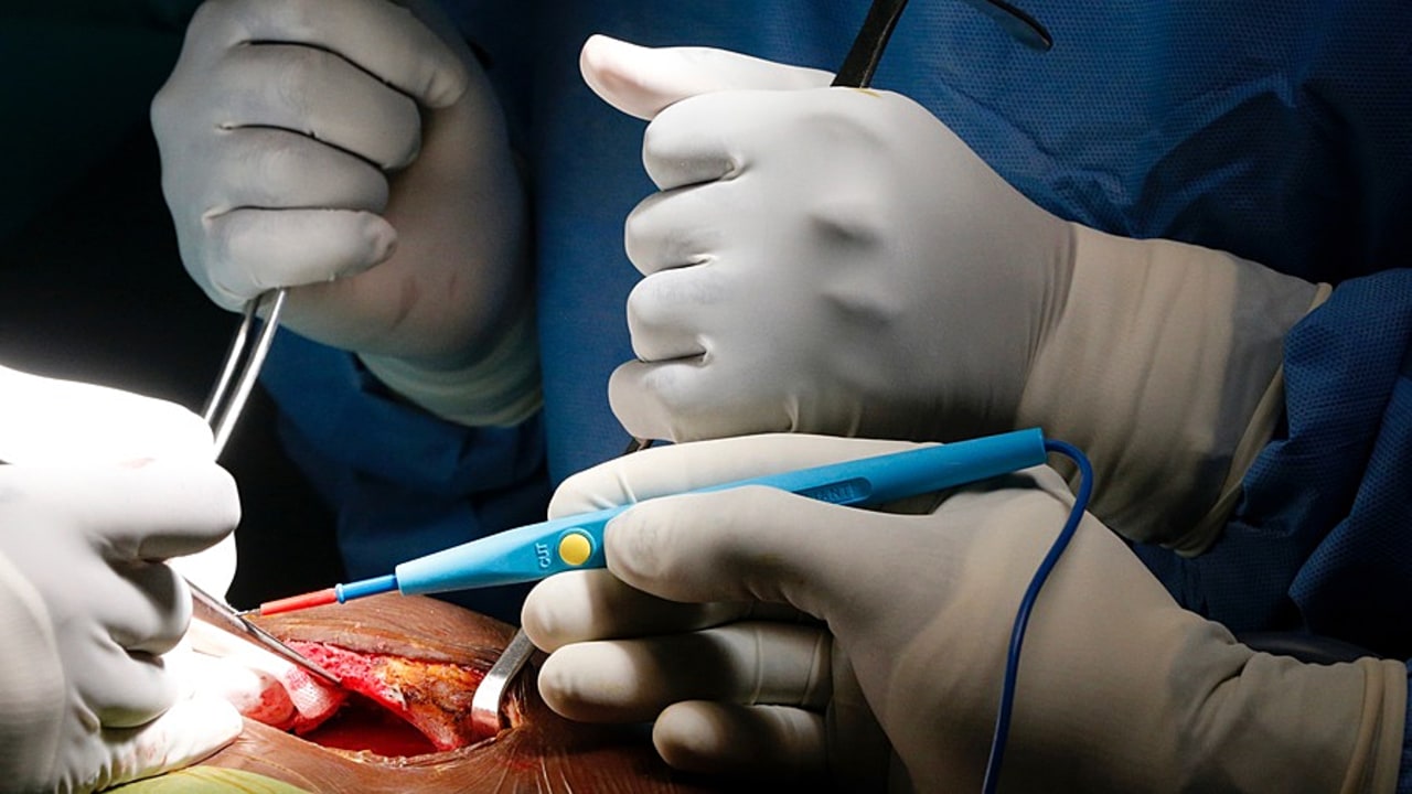 Même à moyen terme, la réouverture du centre du don des corps de Paris-Descartes s'avère "indispensable". En effet, il est aujourd'hui impossible de se passer du "modèle cadavérique" pour former les futurs chirurgiens. (Godong/BSIP)