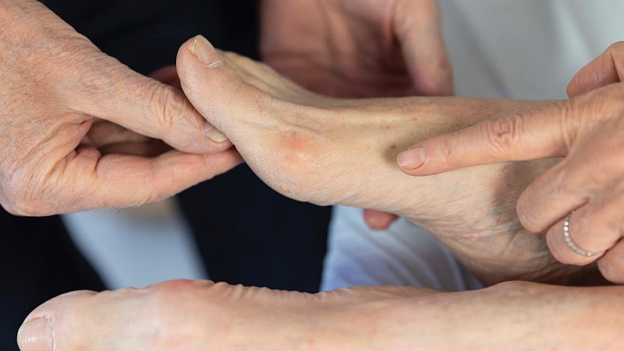 Les pieds des âgés plus fragiles ne doivent pas être laissés sans surveillance. (Collanges/BSIP)