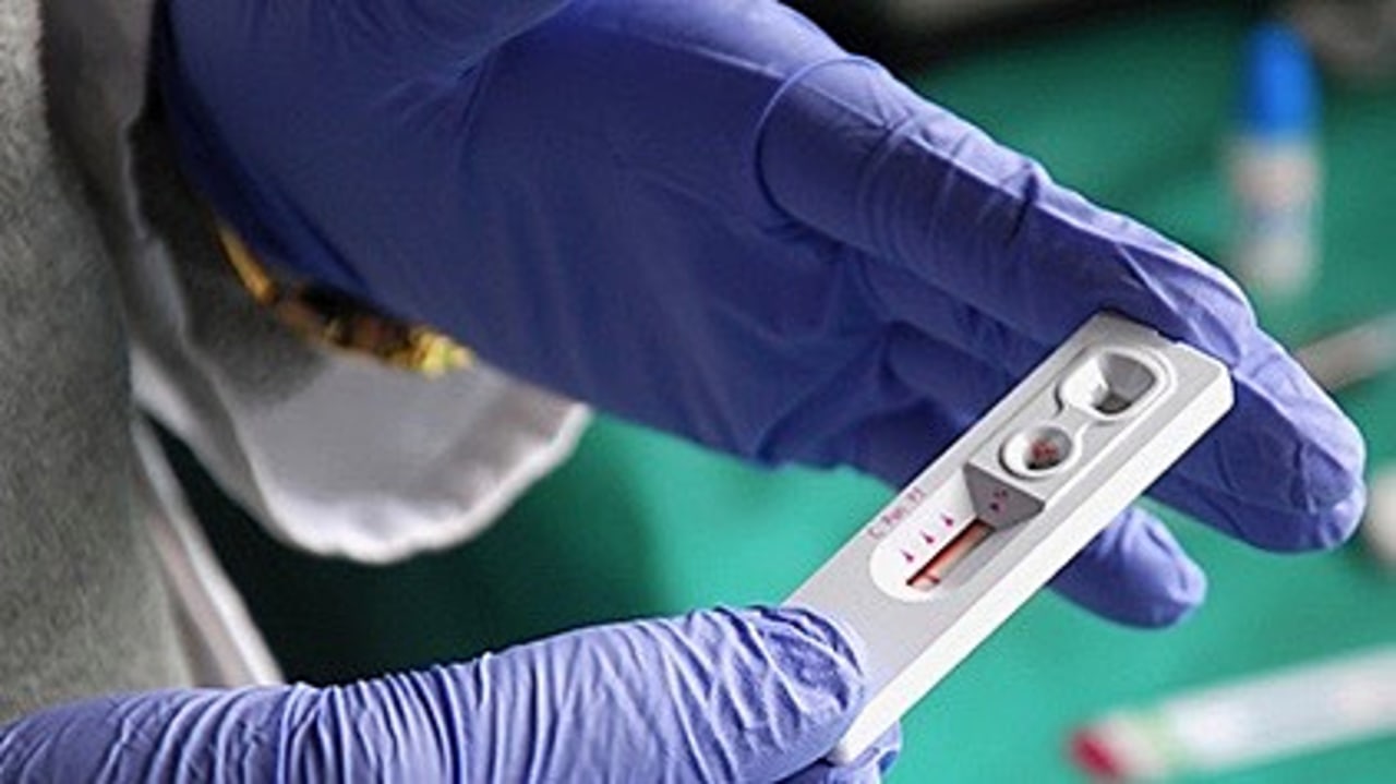 Le ministre des Solidarités et de la Santé a présenté les dernières mesures du Gouvernement pour lutter contre l'épidémie du Sida. (Ministère des Solidarités et de la Santé)