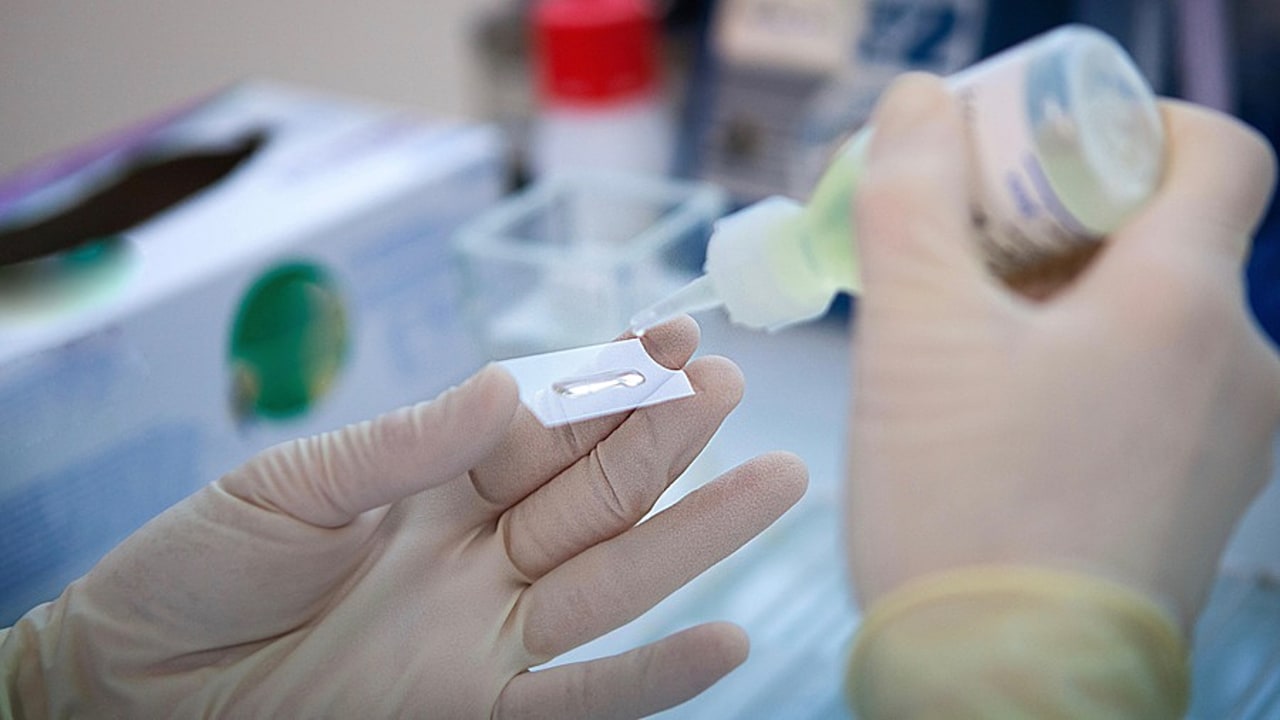 Si l'expérimentation s'avère concluante, ce type de traitement peut être un réel espoir pour les patients souffrant de douleurs résistantes aux autres formes de médicaments. (Amélie Benoist/BSIP)