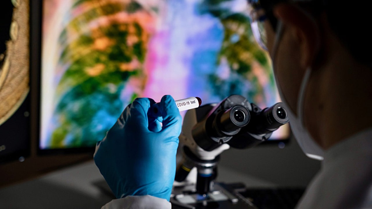 L'ANR a contribué à la dynamique de la recherche sur le Covid-19 en accordant souvent les premiers financements via des appels à projets dédiés. D'autres financeurs y ont aussi contribué au niveau national et international. (Collanges/Image Point FR/BSIP)