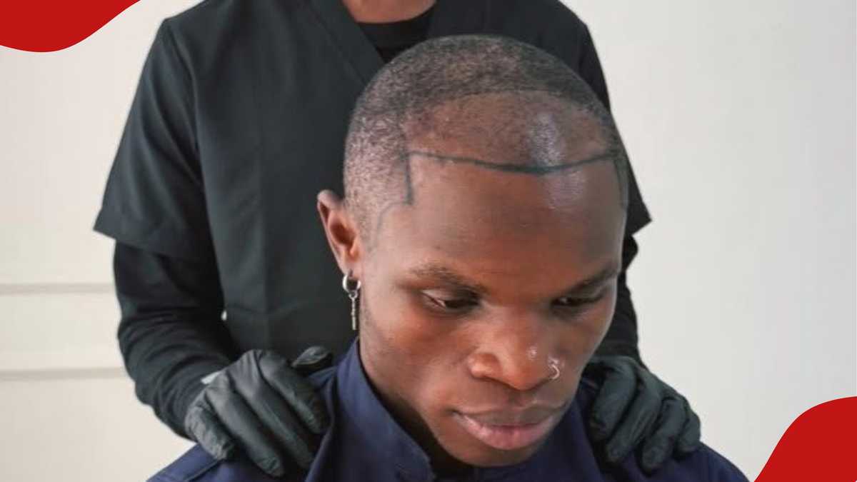Kenyan Creator Reveals Cost of Hair Transplant Procedure