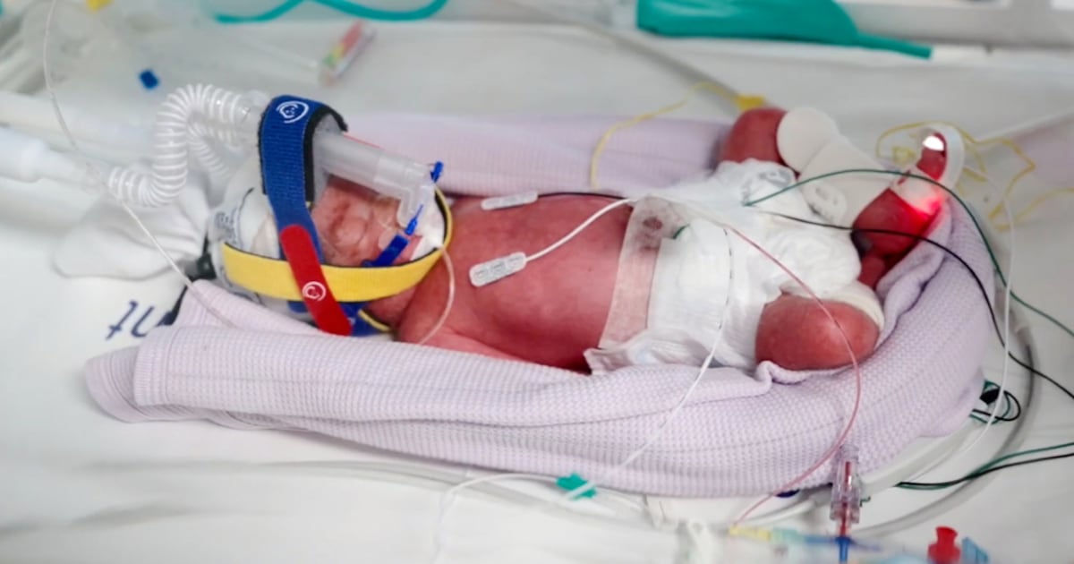 Australian woman delivers identical quadruplet girls in rare natural conception