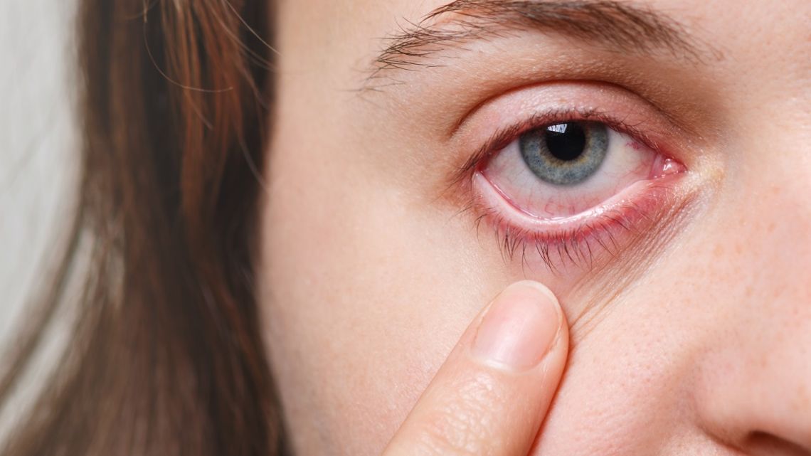 El ojo seco aumenta en invierno por calefacción y pantallas