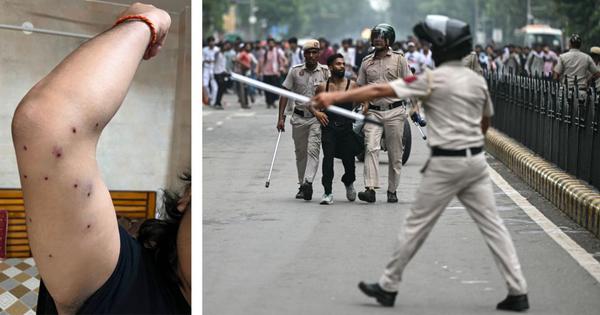 Journalist injured by pellet guns during Delhi student protests