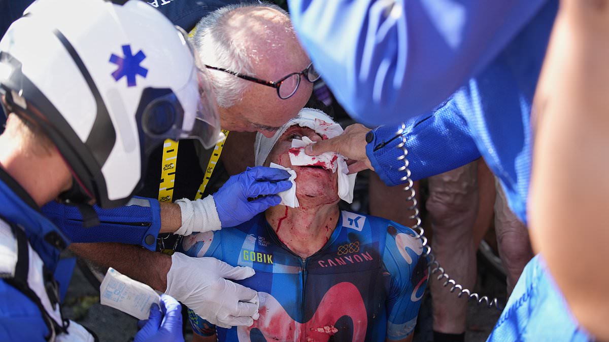 Tour de France cyclist sustains facial injuries after collision with vehicle during stage 19